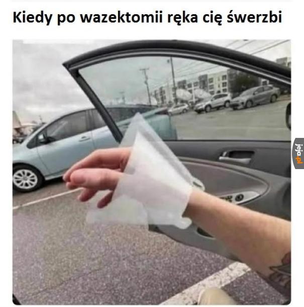 Żeby tylko ręka...