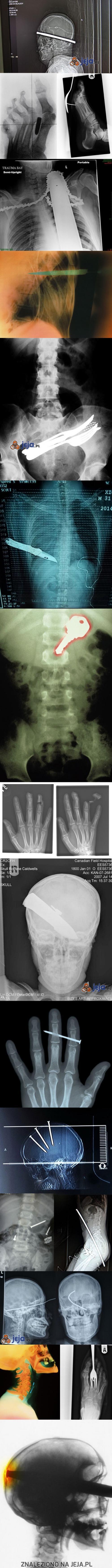 Szokujące zdjęcia rentgenowskie