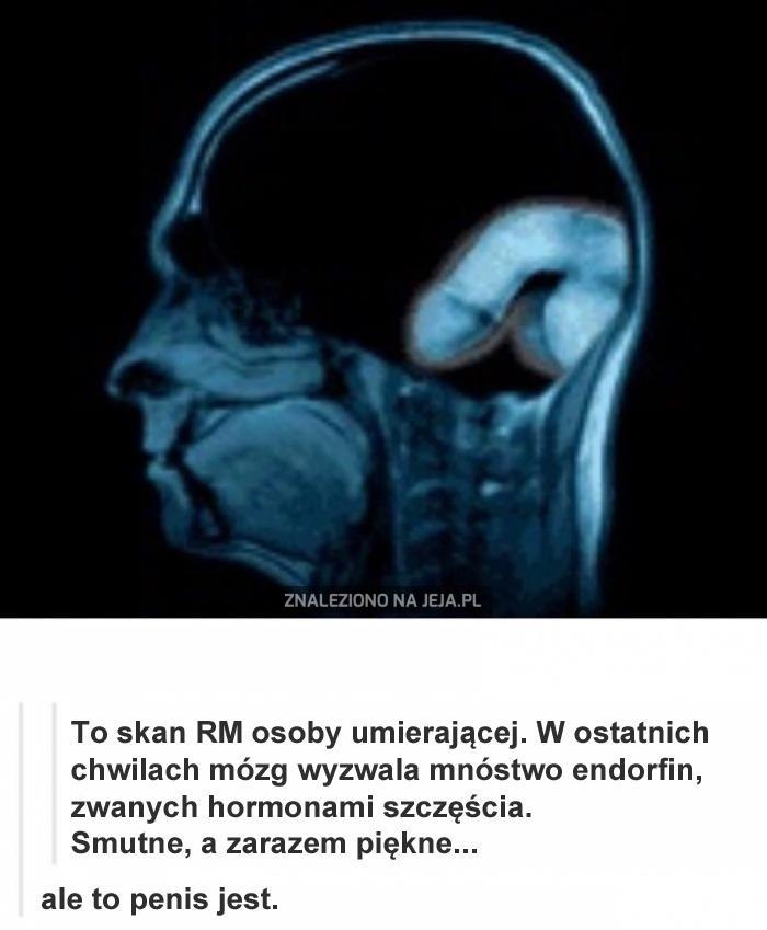 Umierający mózg