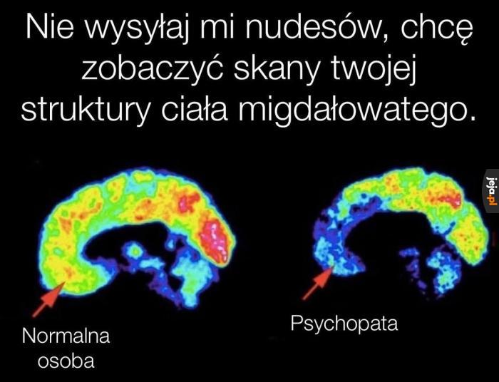 Gorące móżdżki w twojej okolicy