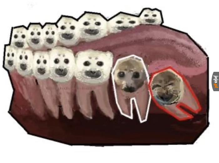 Ząb "mądrości"