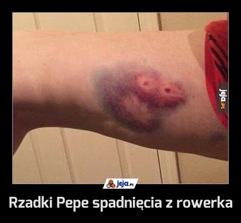 Rzadki Pepe spadnięcia z rowerka
