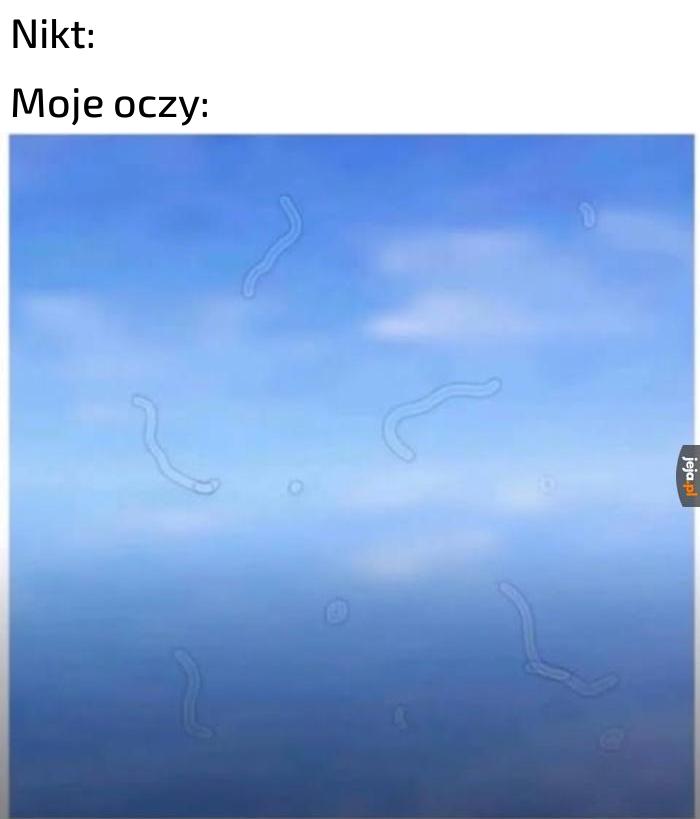 Co to za robaczki jakieś, na pewno tylko ja tak mam