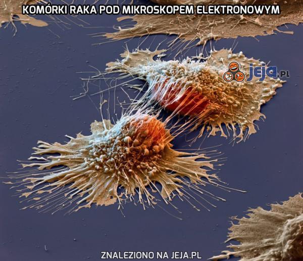 Komórki raka pod mikroskopem elektronowym