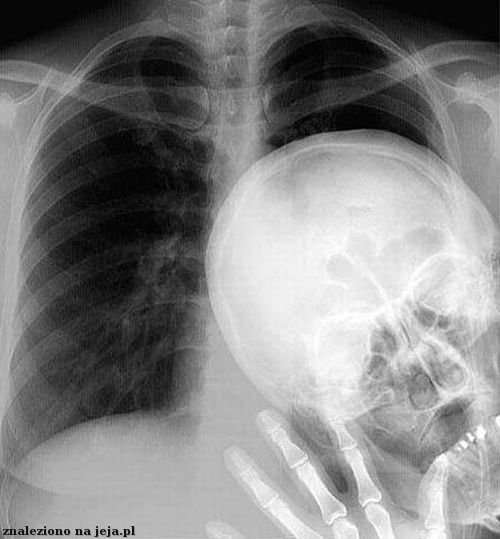 Zdjęcie rentgena