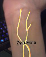komentarz obrazkowy