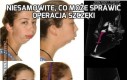 Niesamowite, co może sprawić operacja szczęki