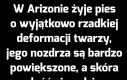 Aż żal patrzeć