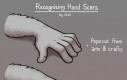 Rodzaje ran na dłoniach