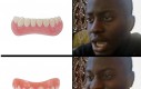 Szybka lekcja stomatologii