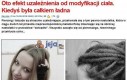 Uzależnienie od modyfikacji ciała