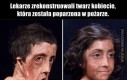 Lekarze zrekonstruowali twarz kobiecie