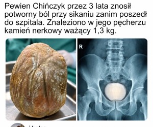 Dbajcie o zdrowie ziomki