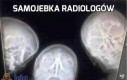 Samojebka radiologów
