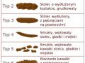 Stolce