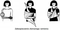 komentarz obrazkowy